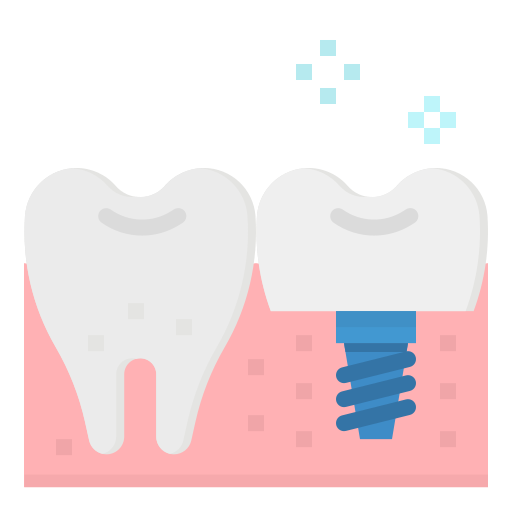 Dental Implant